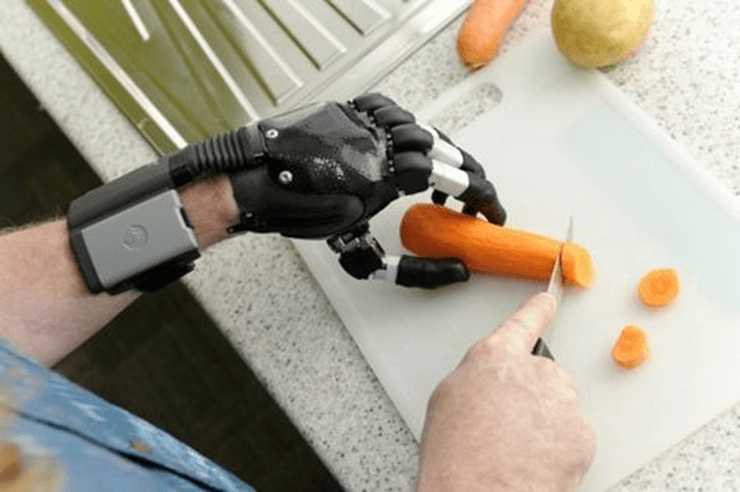 YOUR BRAIN, THE REMOTE: AI'S LEAP IN PROSTHETIC TECHNOLOGY